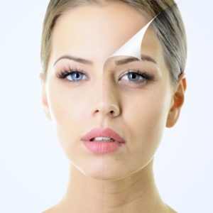 Neck Liposuction Before & After Photos | Vienna | Arlington | Ashburn