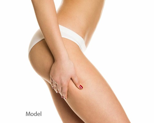 In Office &#8220;Little Lipo&#8221; Liposuction &#8211; No Down Time Fat Remover 